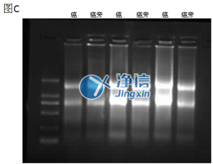 組織勻漿器對(duì)人結(jié)腸癌研磨效果